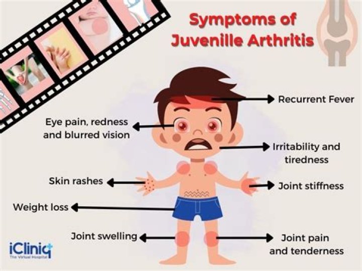 How early can you detect juvenile arthritis?